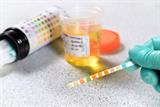 Urine dipstick test